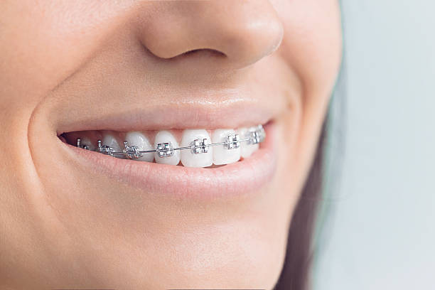 Best Pediatric Dentistry  in Simonton Lake, IN